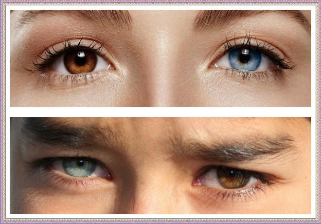 Глаза стали разного. Один глаз серый другой Карий. Один глаз голубой другой Карий. Один глаз Карий другой зеленый. Мутация цвета глаз.