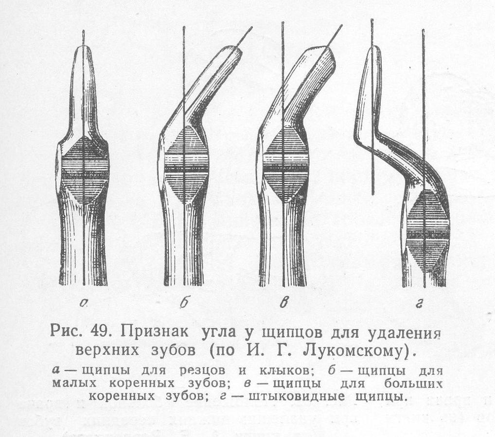 Удаление верхнего зуба инструменты. Инструменты для удаления зубов на верхней и нижней челюсти. Элеватор для удаления зубов на верхней челюсти. Элеватор для удаления зубов на нижней челюсти. Удаление корней на верхней челюсти инструменты.